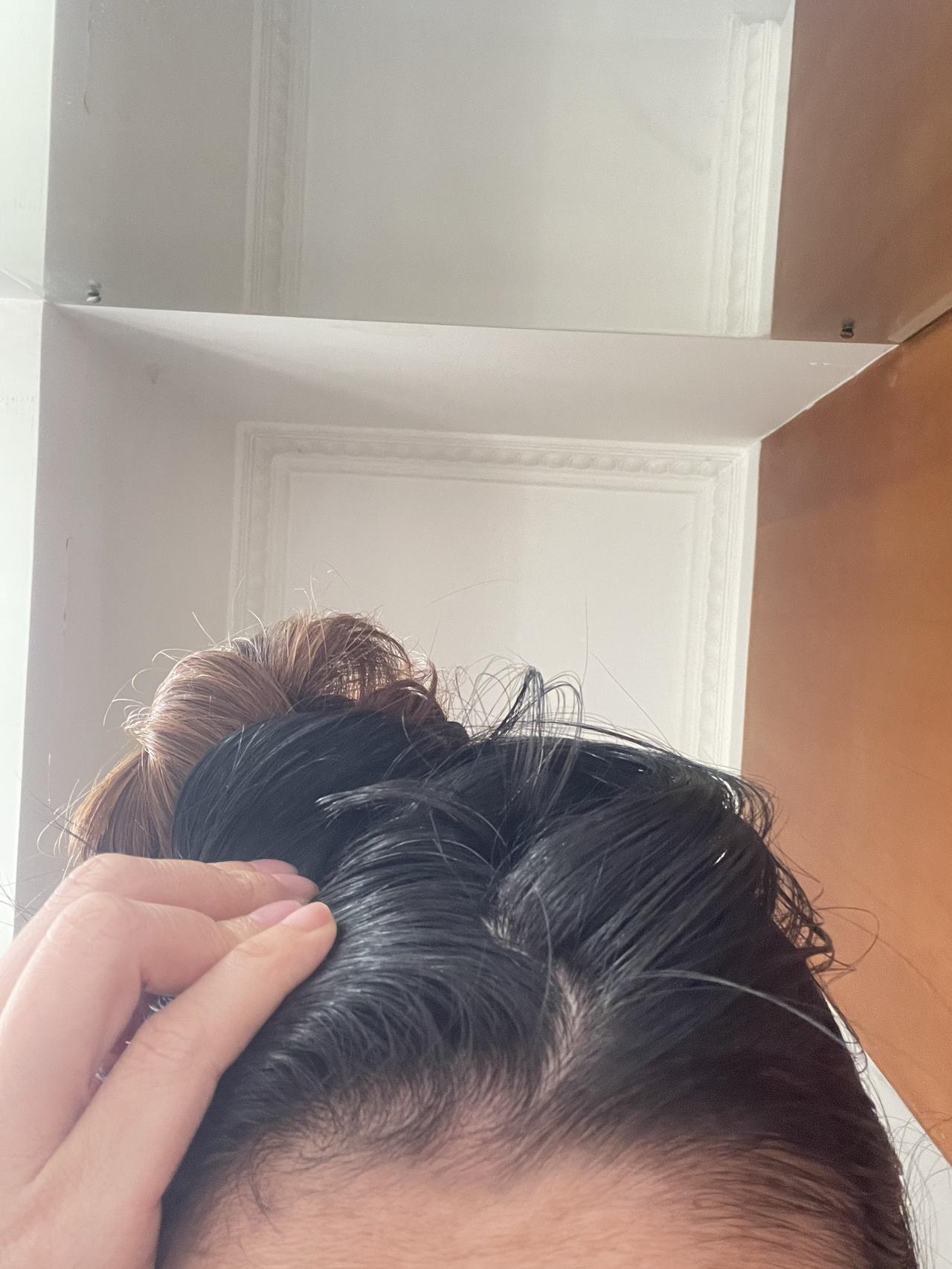 慌了慌了，
我现在不到40岁，
怎么开始不停的长白头发，
一开始只有1条，现在拨