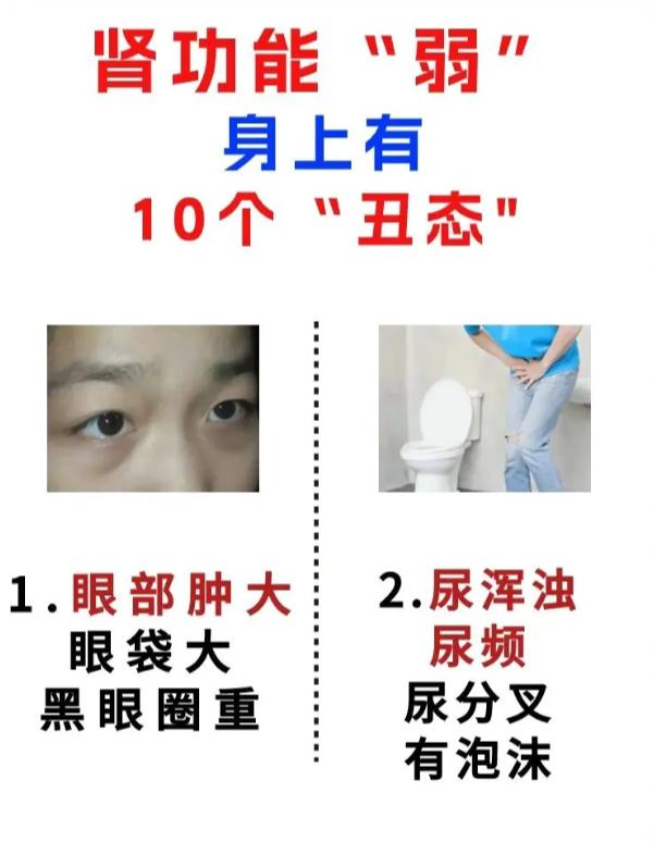 肾脏功能偏弱，身体会出现这 10 个信号