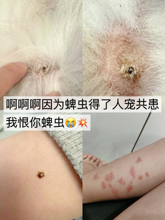 啊啊啊啊我恨你蜱虫😭❗还我健康生活‼