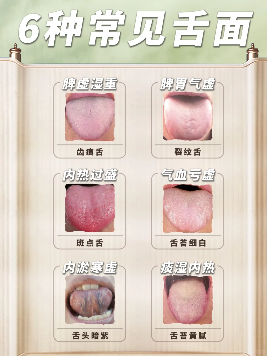 6种常见舌面的亚健康👅你学会了吗❓