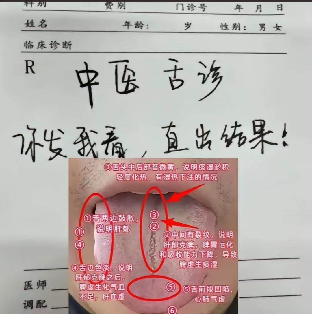 今日周四，有空，继续舌诊挑战，争取今天能看够1000个舌象。 

不管是脾虚、肝