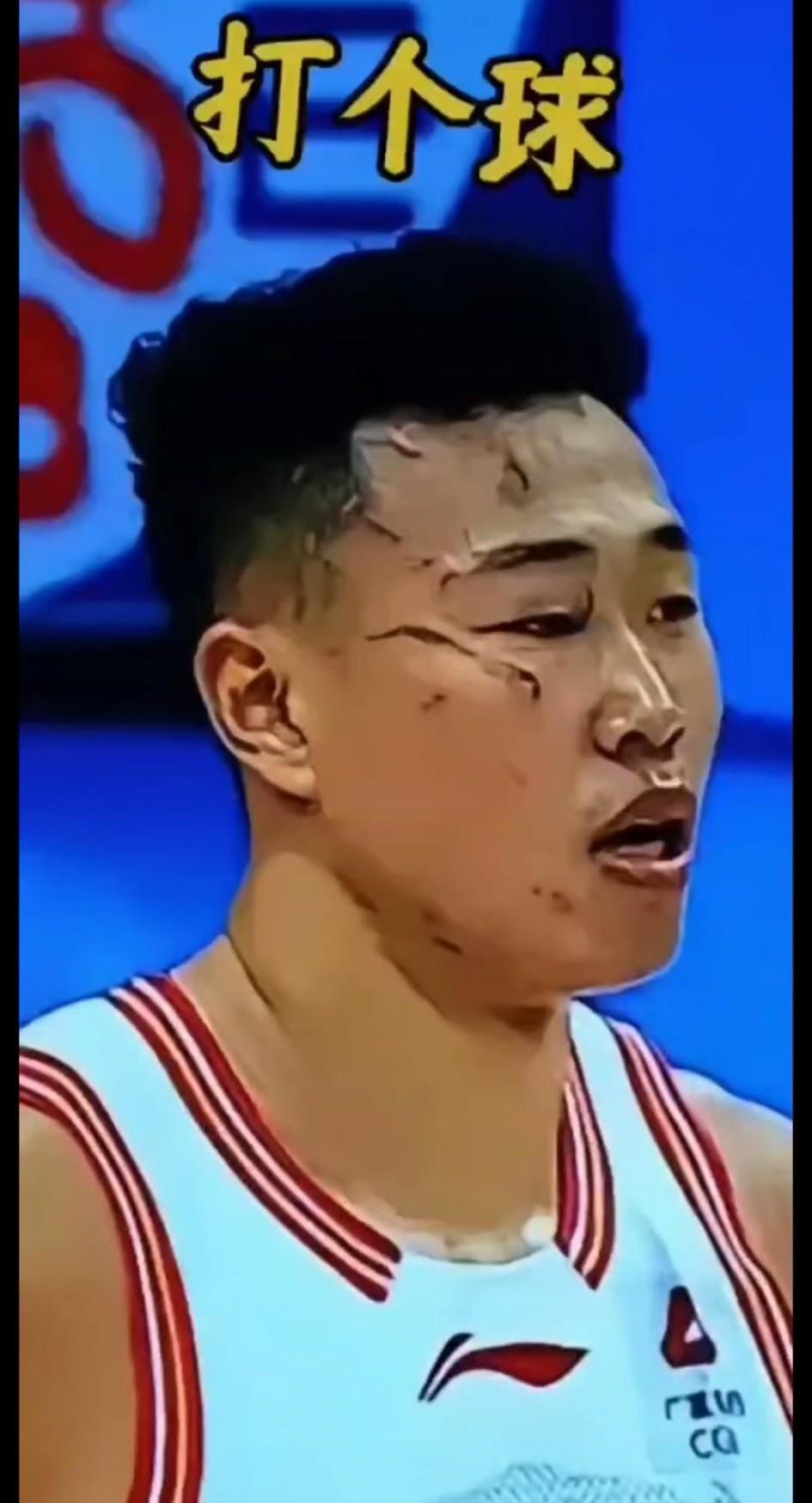 看到这个画面你有没有觉得现在的篮球比赛变味了，打个比赛把脸都抓花了，这哪儿还是篮