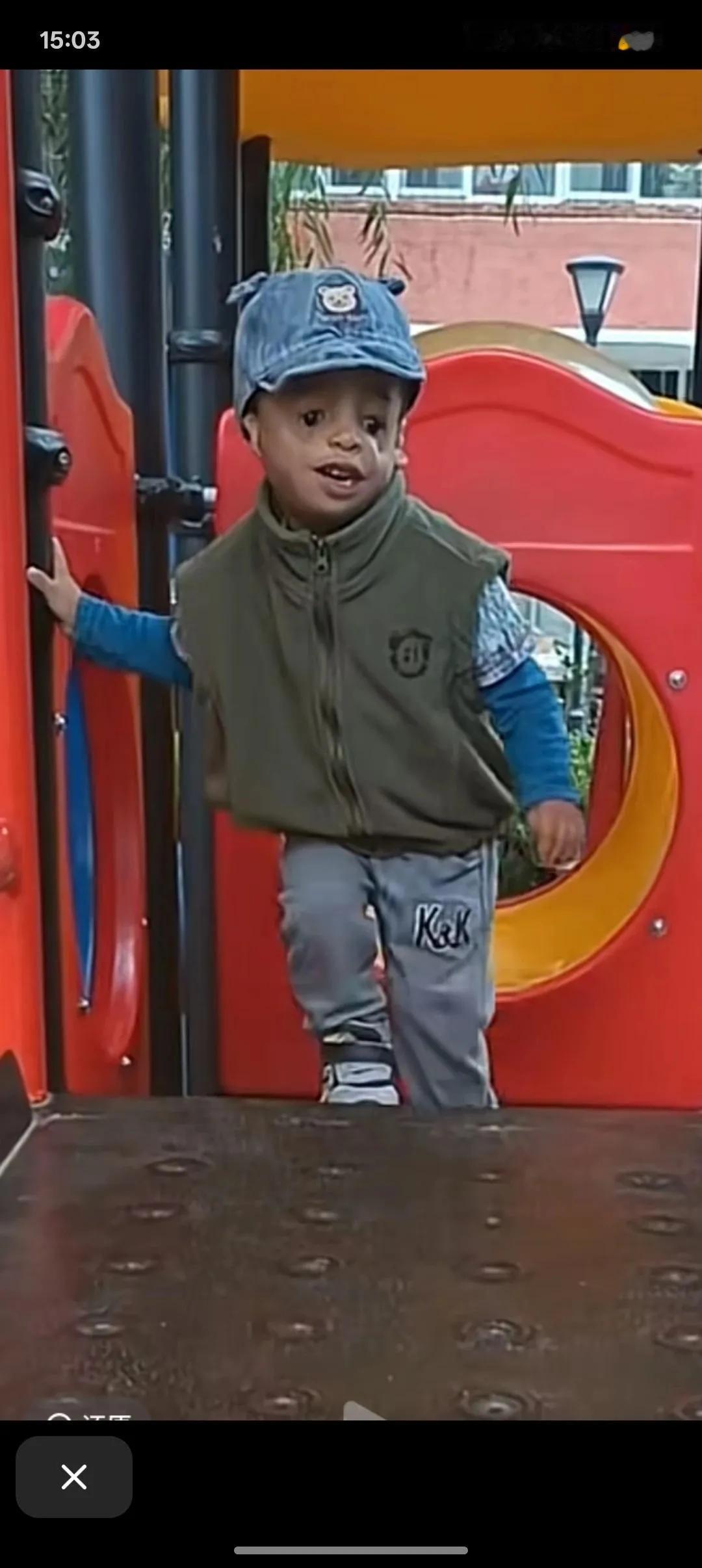 吉祥长这样，都怪他的爸爸妈妈，阿凡达长得就是鸟面人，按照医院的惯例，肯定会要求查