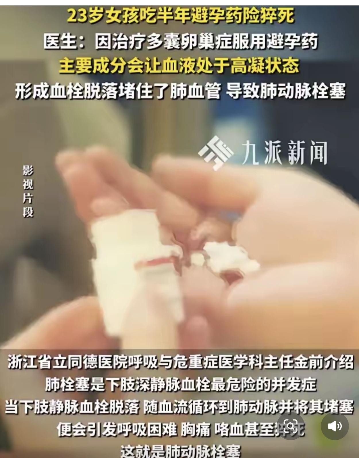 浙江杭州， 一23岁女孩连续半年服用避孕药，没想到她有次身体不舒服，老是干咳，五