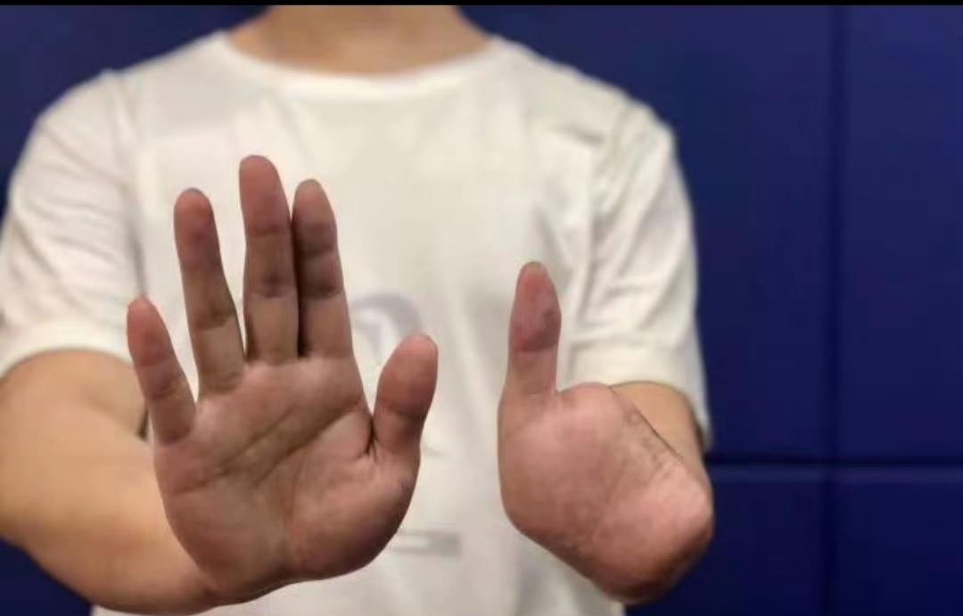 手指泡酒视频疯传，高薪梦变断指地狱，谁在暗处等你上钩？

最近网上流传一个视频，