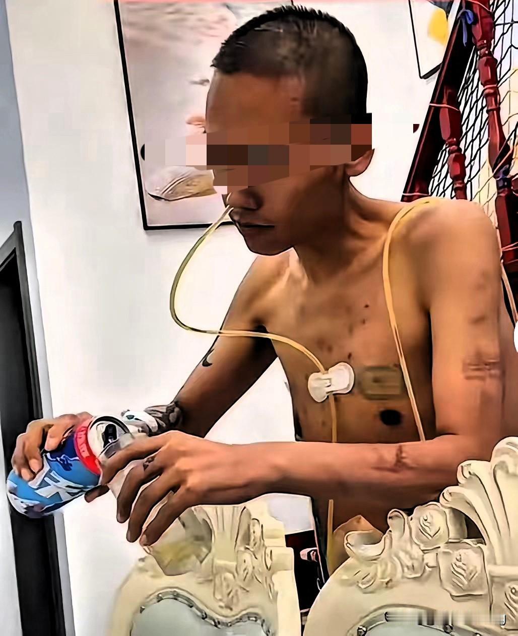 生死看淡！四川肝癌晚期男子放弃治疗喝啤酒，这不是洒脱是藏着最深的无奈！

他在工