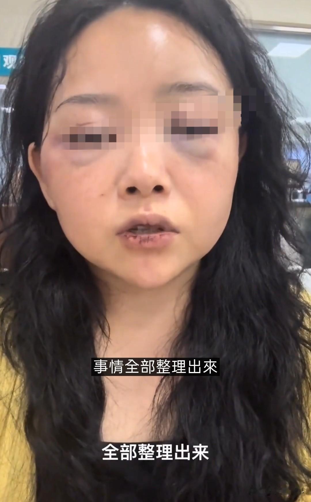 胆子真大，网恋前往菲律宾奔现，最后带着满身伤痕回国，不过还算幸运，至少能够平安回
