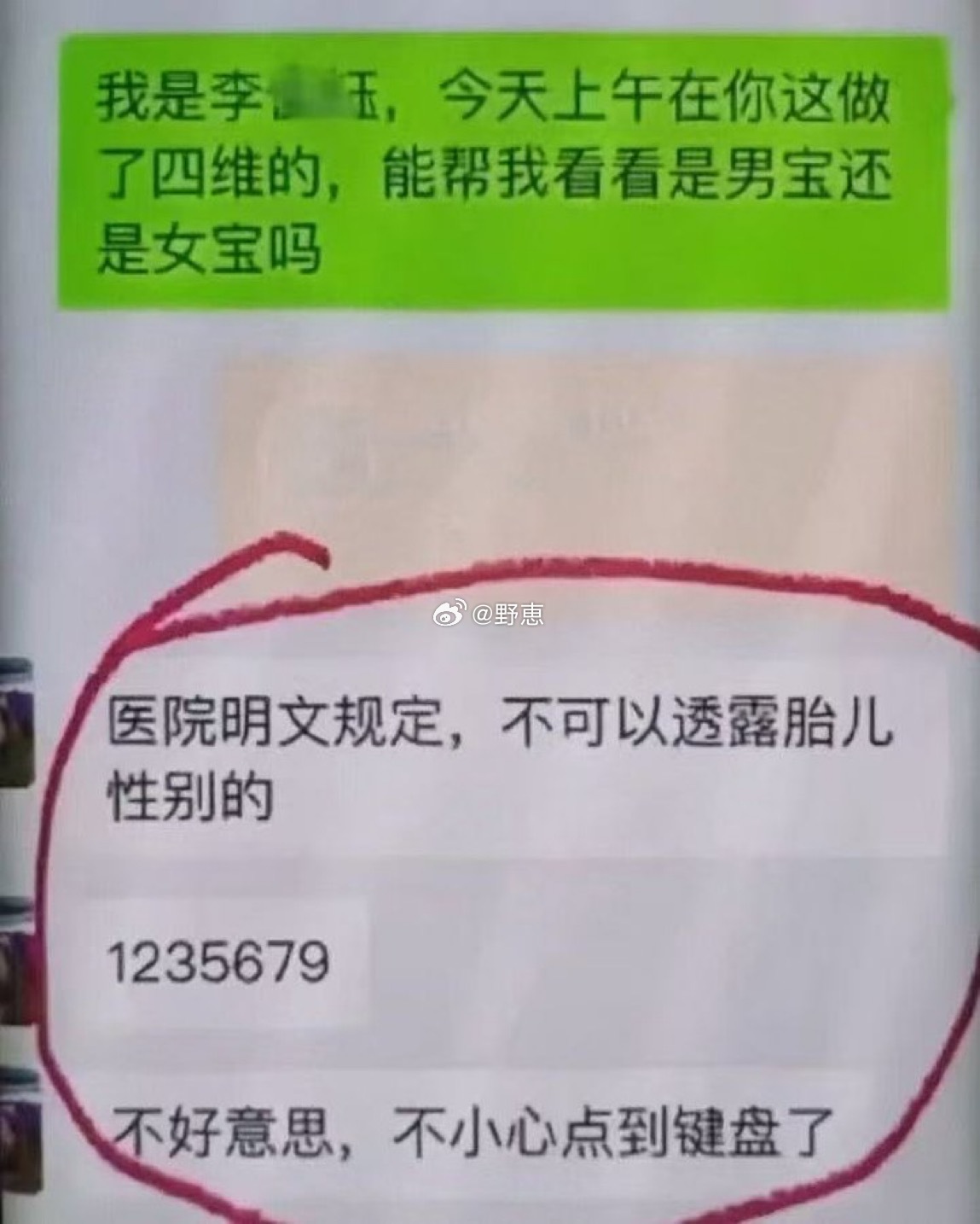 其实医生已经说得很明白了，家属硬是没听懂🤣 ​​​