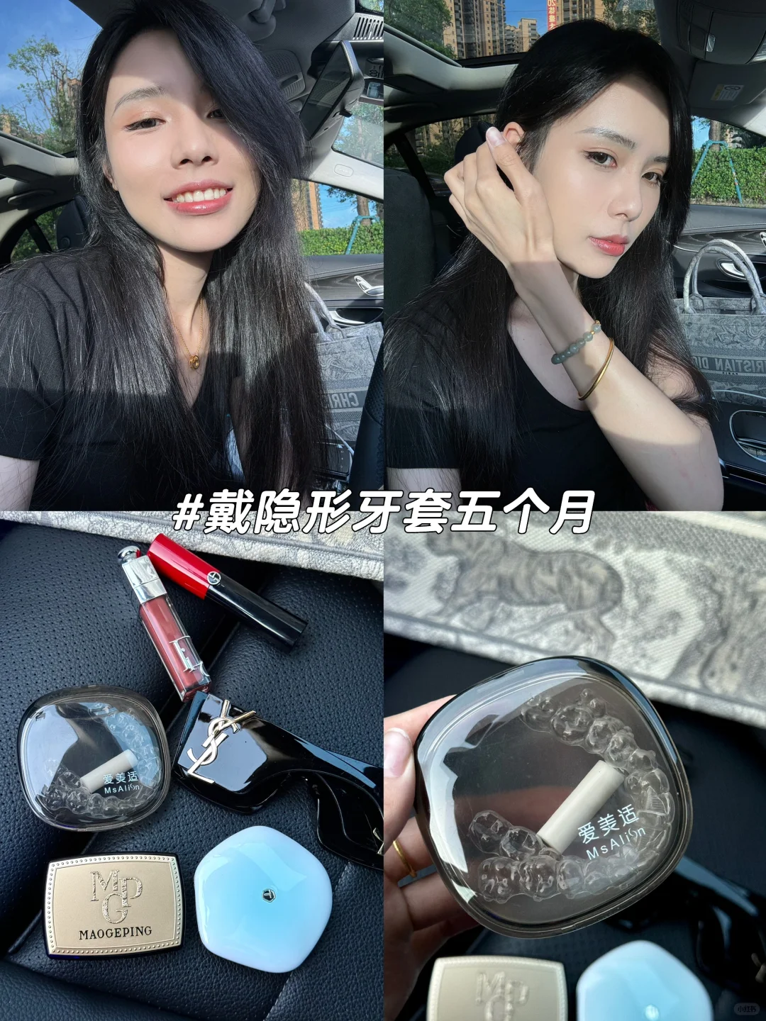 男朋友说我的嘴巴没那么凸了