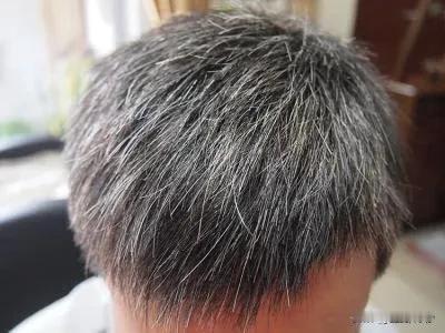 惊！白发增多困扰你？揭秘3大食物黑发秘诀，别只知道黑芝麻了！

白发早生，烦恼不