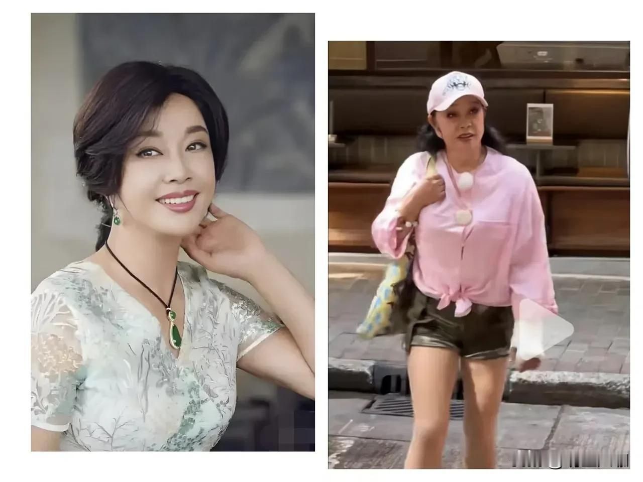 刘晓庆耳朵👂都到哪了，没拉过皮谁信啊，不过70多岁的人了身体这样已经盖过大多数