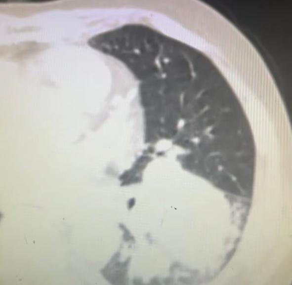 刚下手术台，我心里满是欢喜。紧接着，我们团队又打了盒饭，一起回办公室用餐，这份普