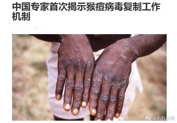 中国医学科学院、中国科学院等近日发布一项最新研究成果：在全世界首次揭示猴痘病毒D
