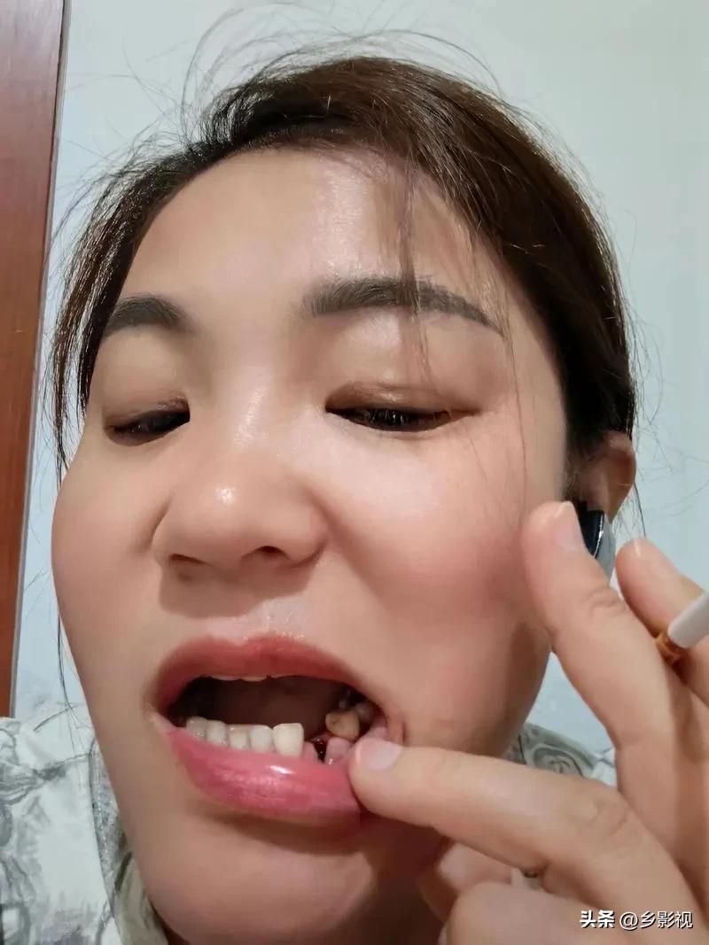 蛀牙酸胀折磨得睡不着，一心想拔了一了百了？
先别急躺牙椅！不是所有人都能随便拔牙