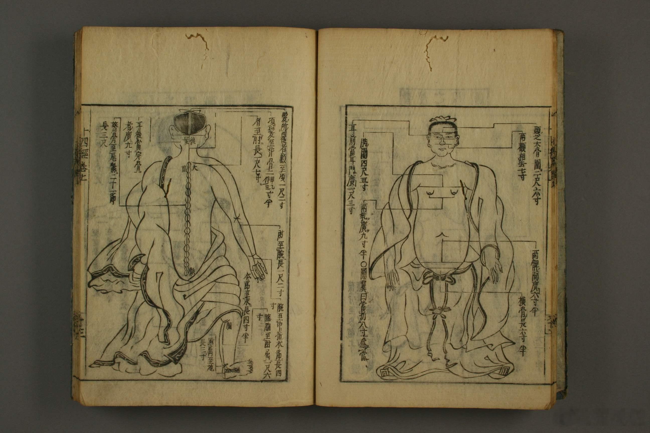 《医学至要抄》是日本江户时期综合性汉方医籍，共二卷，元禄十二年（1699）刊刻流