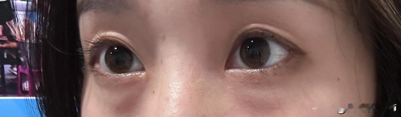 我才23啊……这是咋了
摸鱼拿出手机自拍，结果不看不知道一看吓一跳
原相机下才发