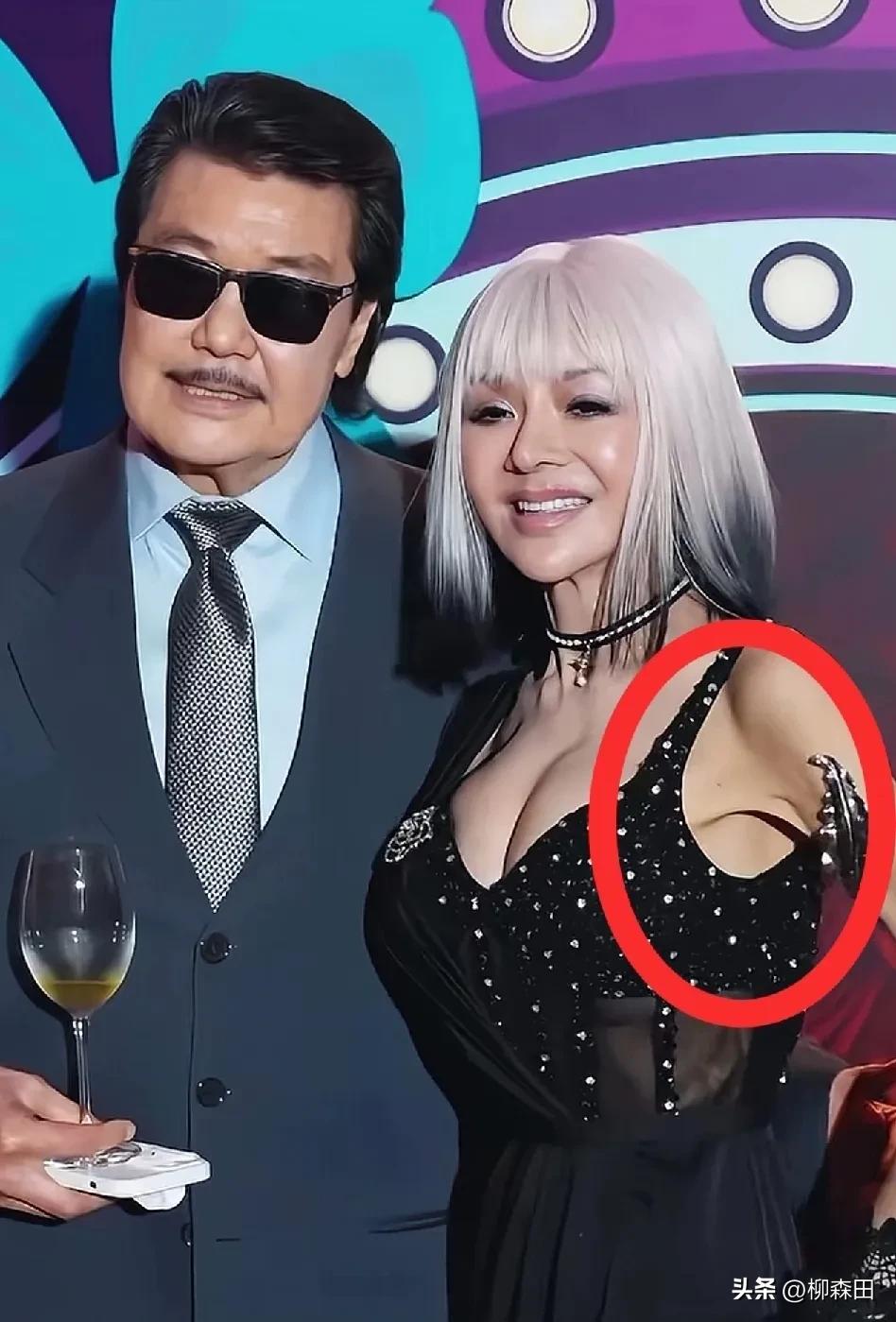 59岁叶子楣“支撑”力下降，腋下皮肤松弛下垂明显，就剩薄薄的一层皮了。年轻时的叶