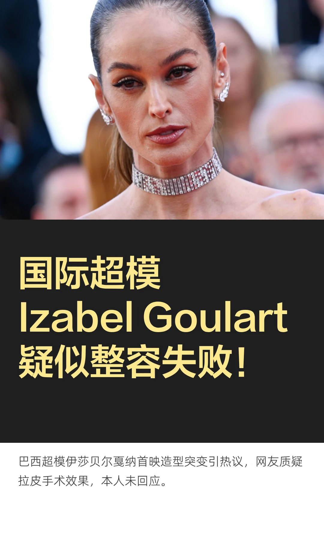 国际超模Izabel Goulart疑似整容失败！