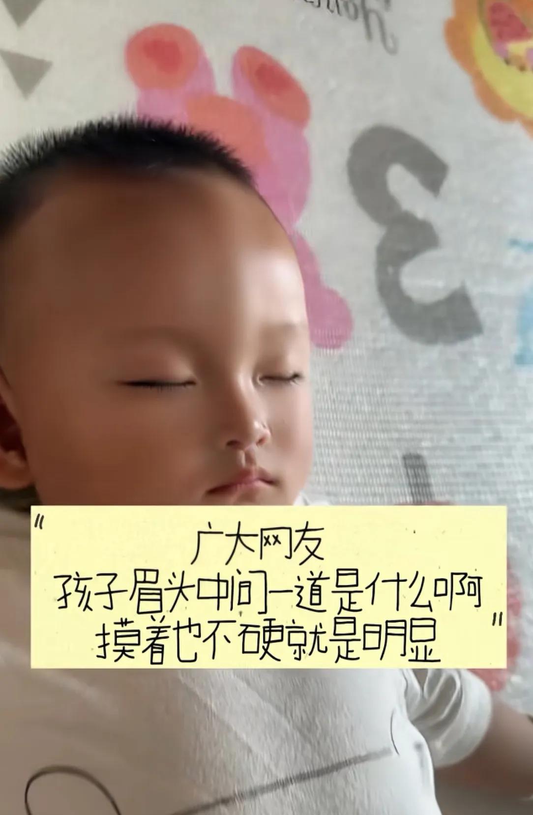孩子生下来眉头中间就有一道凸起，这是什么呀？