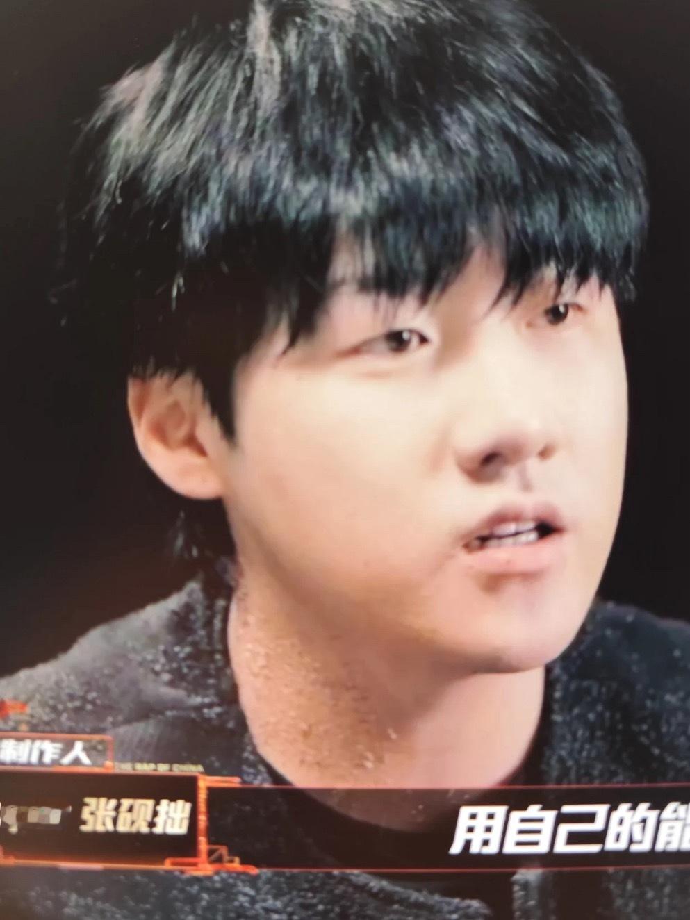 capper哥你脖子咋了？？？纯路人…好奇脖子怎么了 ​​​
