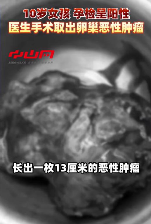 万万没想到！广东中山，一10岁女孩一周前开始腹痛，几天后下身莫名流血。家人带她就