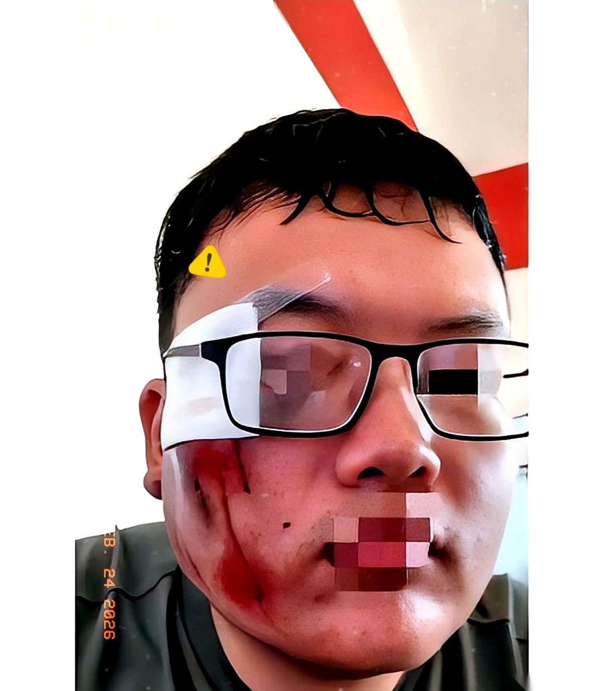 他递给我1000块，想私了。
我没要，反手开了张2000的罚单，心里还觉得自己特