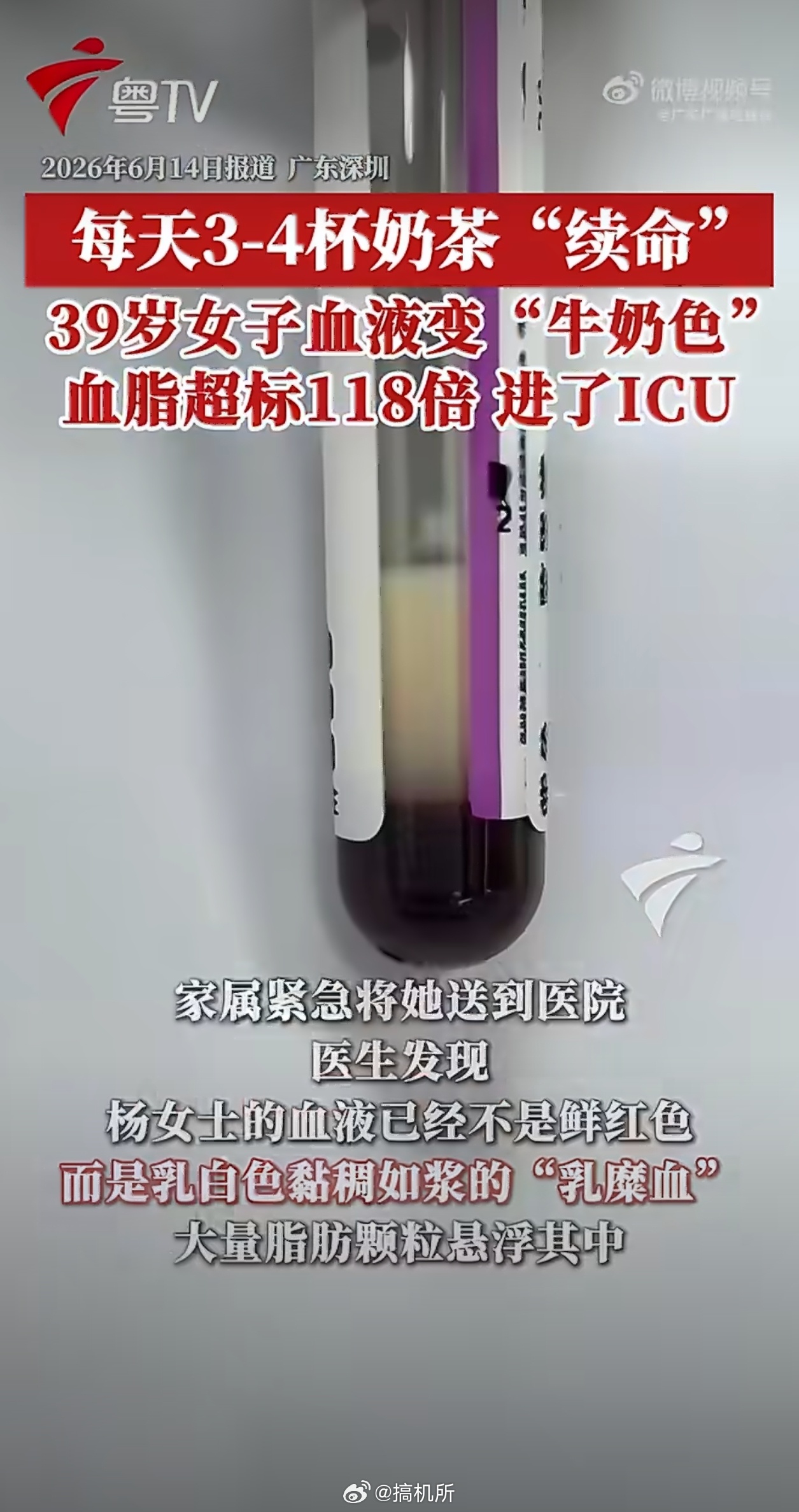 39岁女子1天3杯奶茶喝出牛奶血这个月我好像一杯奶茶都还没喝过
