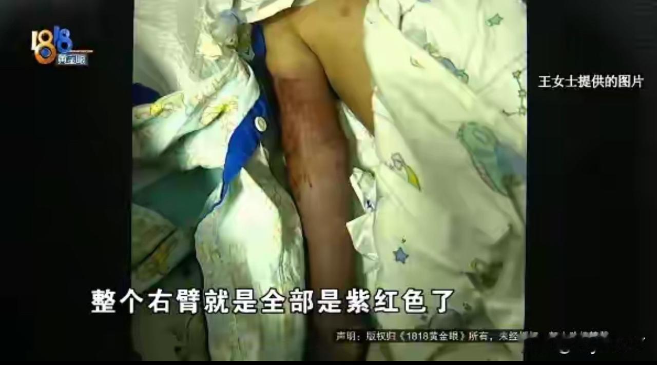 **盛夏泳池藏隐患 排水口吸人悲剧再敲警钟**

上海6岁男孩意外死亡，在酒店游