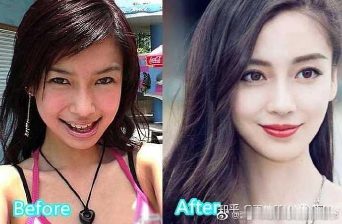 时下社会整容非常的流行，特别是对于爱美的女人来说，更是犹如过江之鲫，韩式整容我个