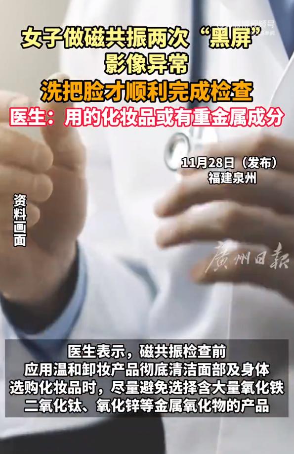 解释不清了！福建一位 29 岁女生因头晕前往医院做头颅磁共振检查，本想快速查清头