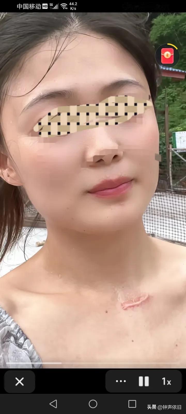 纹身，对于大多数人来说有点讨厌。但有些人就适合纹身，像这位美女颈下有一个手术痕迹