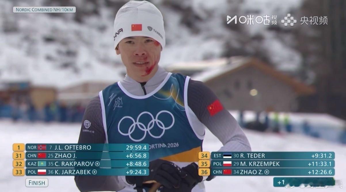 为体育精神点赞！中国队员面带鲜血过终点线米兰冬奥会北欧两项男子标准台＋10KM越
