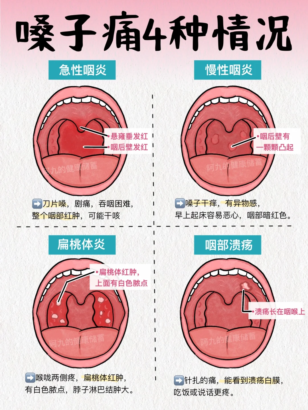 嗓子干痒痛总不好？用对方法才高效！