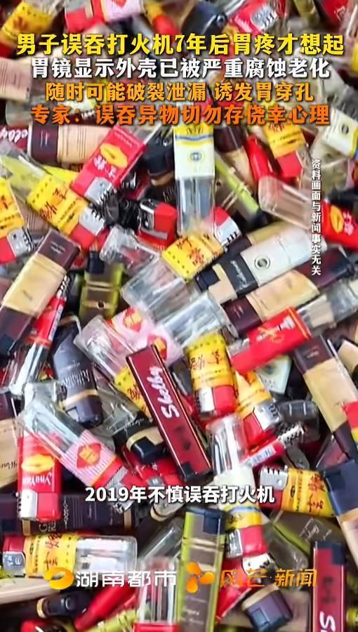 “命真大！”8月6日报道，江苏，一男子7年前误吞了打火机，当时他也没不舒服，就把