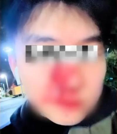 “严查到底！”2月24日重庆，一男子出小区遛狗时，突然被女邻居家2条未栓绳的狗追