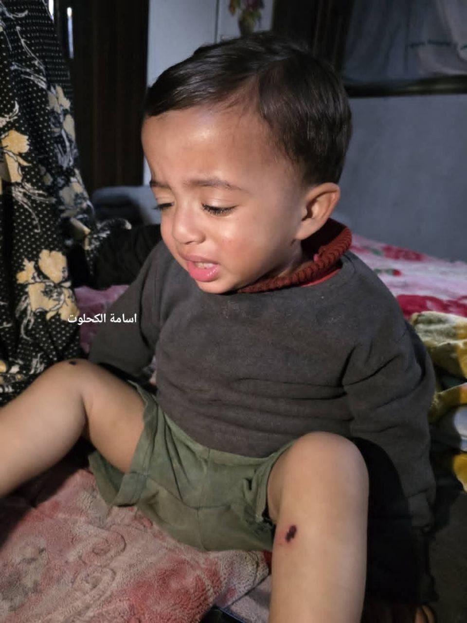 禽兽不如！据土耳其国家公共广播公司：以色列士兵在加沙对一名一岁儿童施以酷刑，包括