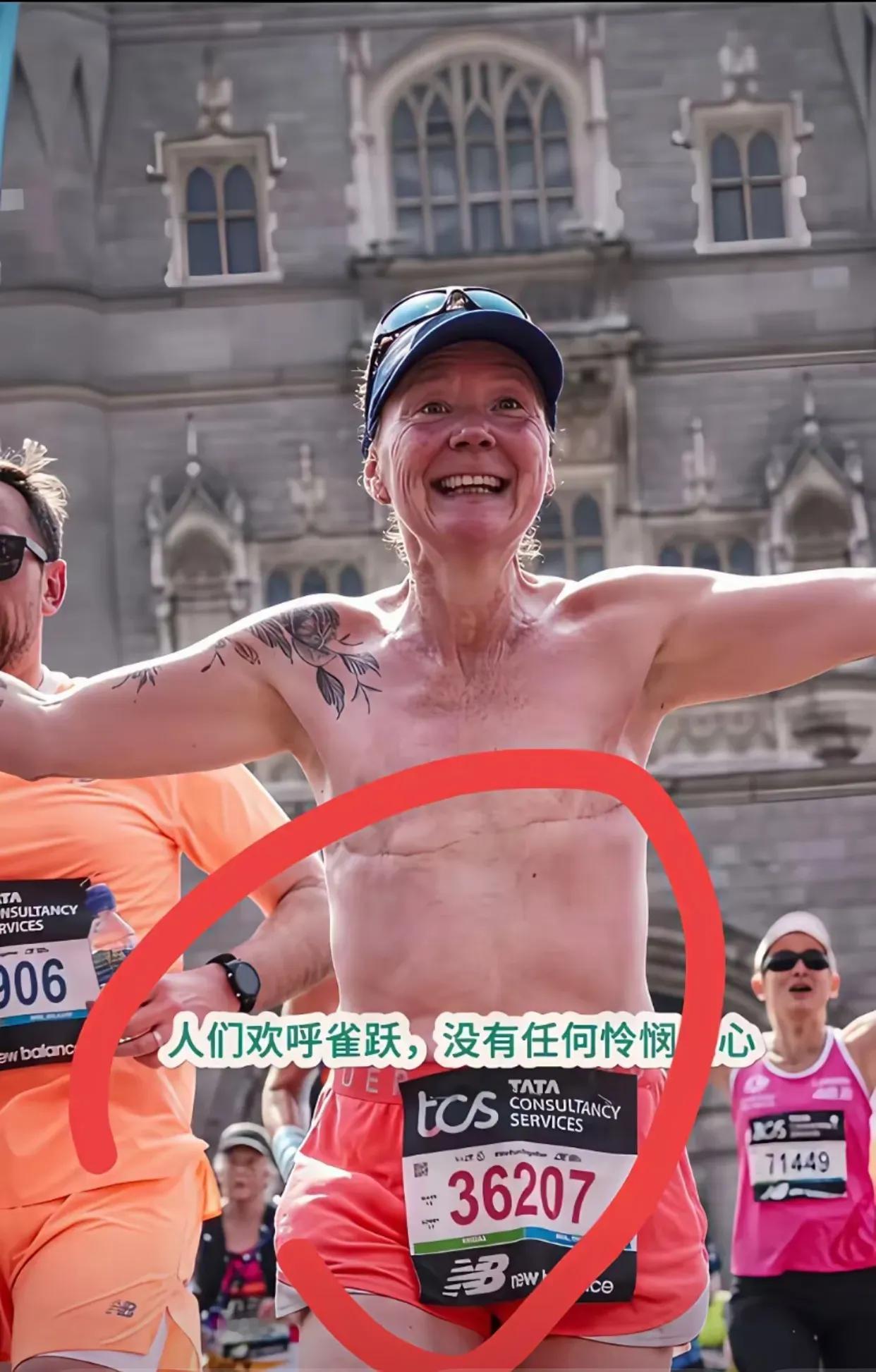 说真的，这种女性太勇敢了。
现在越来越多女性得了乳腺癌，不得不割去双乳。
一旦女
