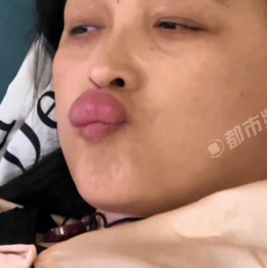 慎亲！女子亲宝宝脚丫，嘴唇当场肿成香肠嘴，所有家长都要警惕
 
很多家长带娃时，