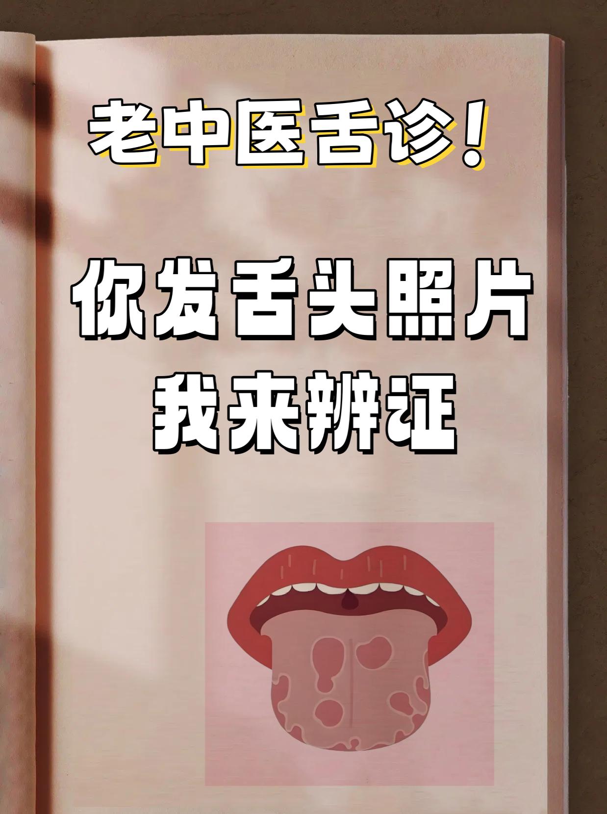 又是看舌头的一天！

只要你发，我就看，绝不漏掉一个！

今天空出来时间了，继续