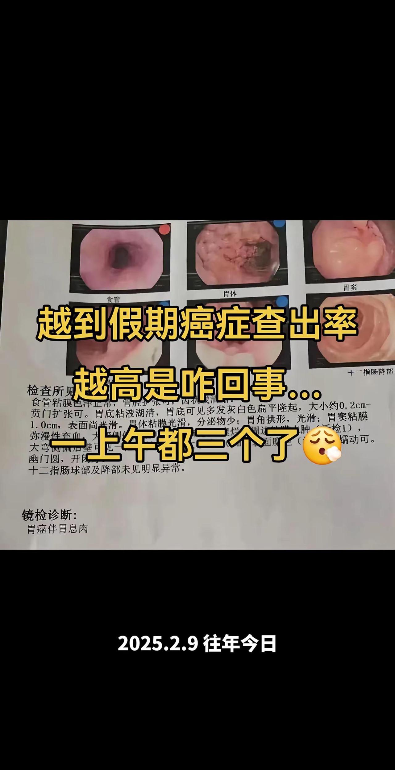 越到假期越容易查出来这个 唉。