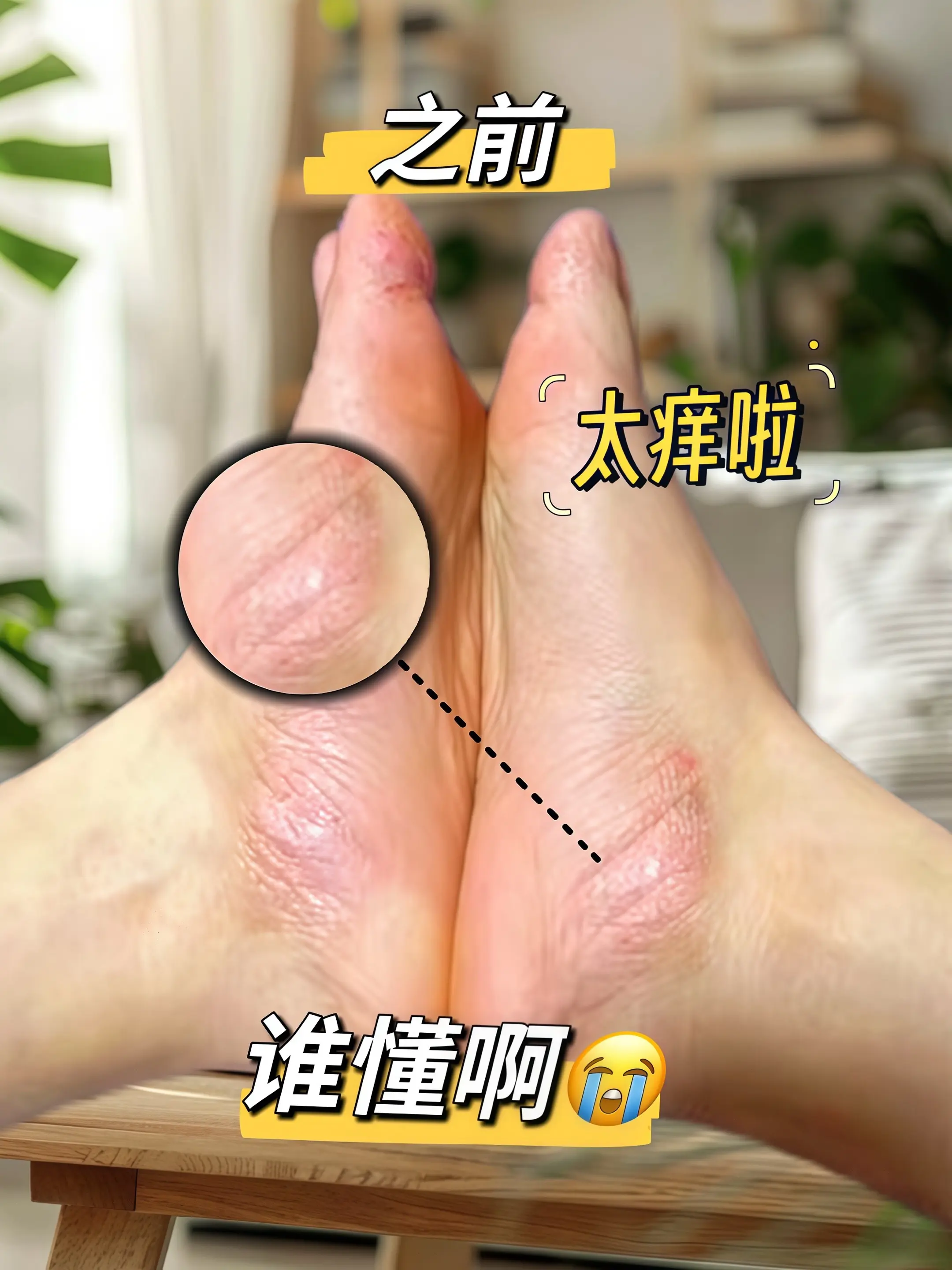 后悔没早点知道，原来这么好用。 足部护理美脚