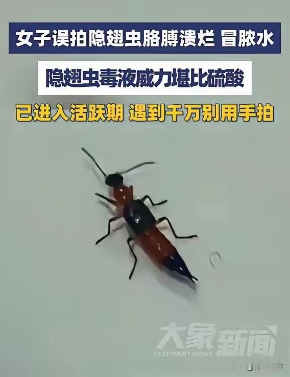 紧急提醒！浙江义乌有人拍死小虫，手臂溃烂！隐翅虫有多危险？
 
5月29日有相关