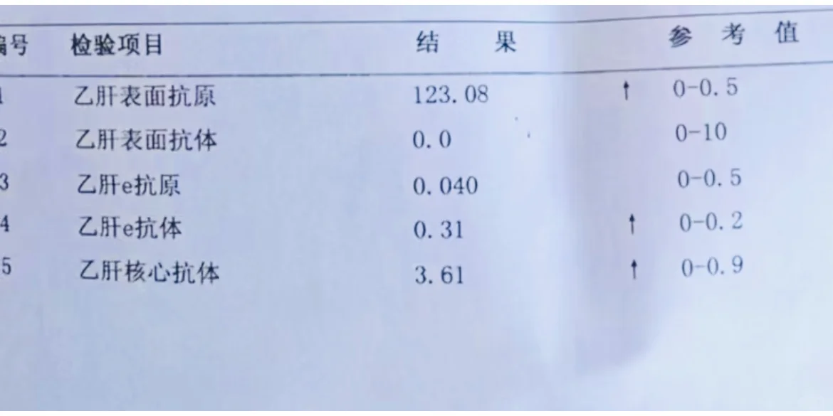 乙肝优势人群你知道多少？