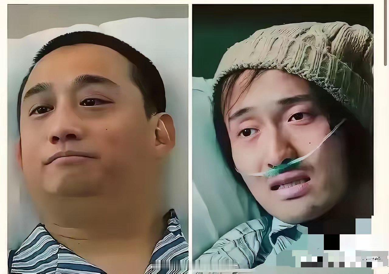 同样是扮演病人，演技一目了然 ​​​