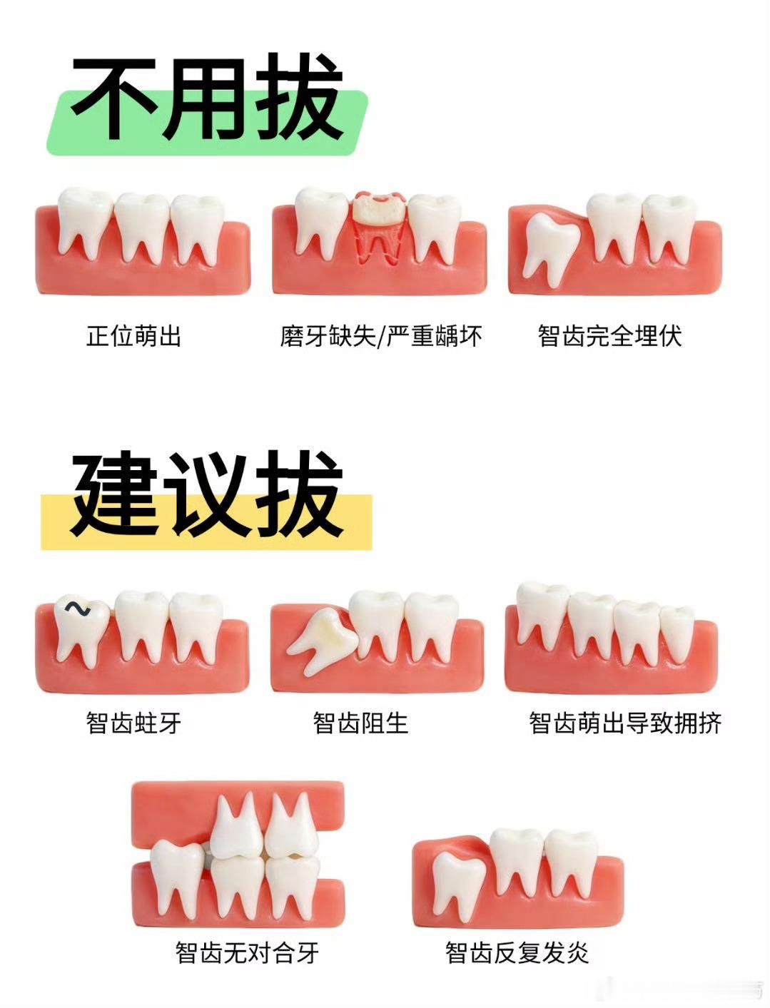 那我花钱去拔智齿算什么建议拔掉1. 反复发炎肿痛、张嘴受限2. 横着/斜着长，顶