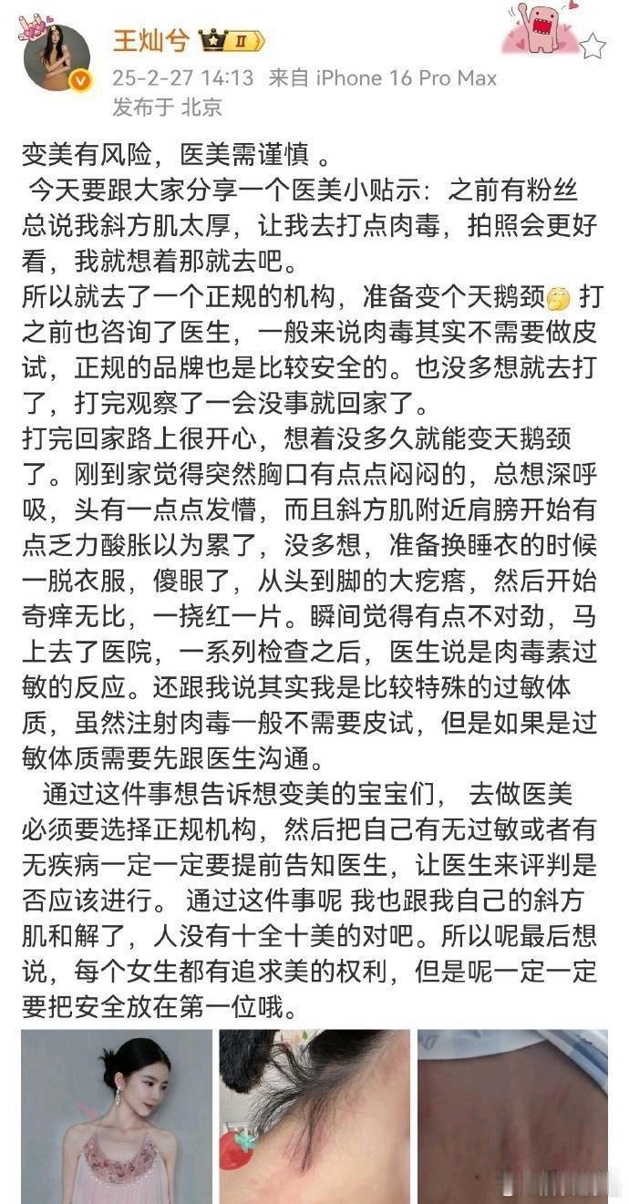 杜淳老婆自曝打肉毒全身过敏，全身奇痒无比，呼吁大家在做医美前要了解自己的过敏原或