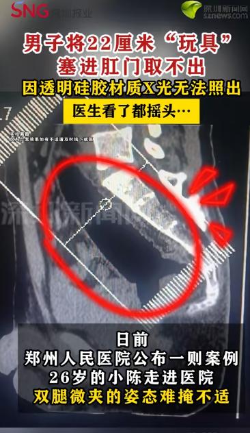 太离谱了！河南郑州，一男子捂着屁股去医院肛肠科看病，可问诊时，男子却扭扭捏捏说屁