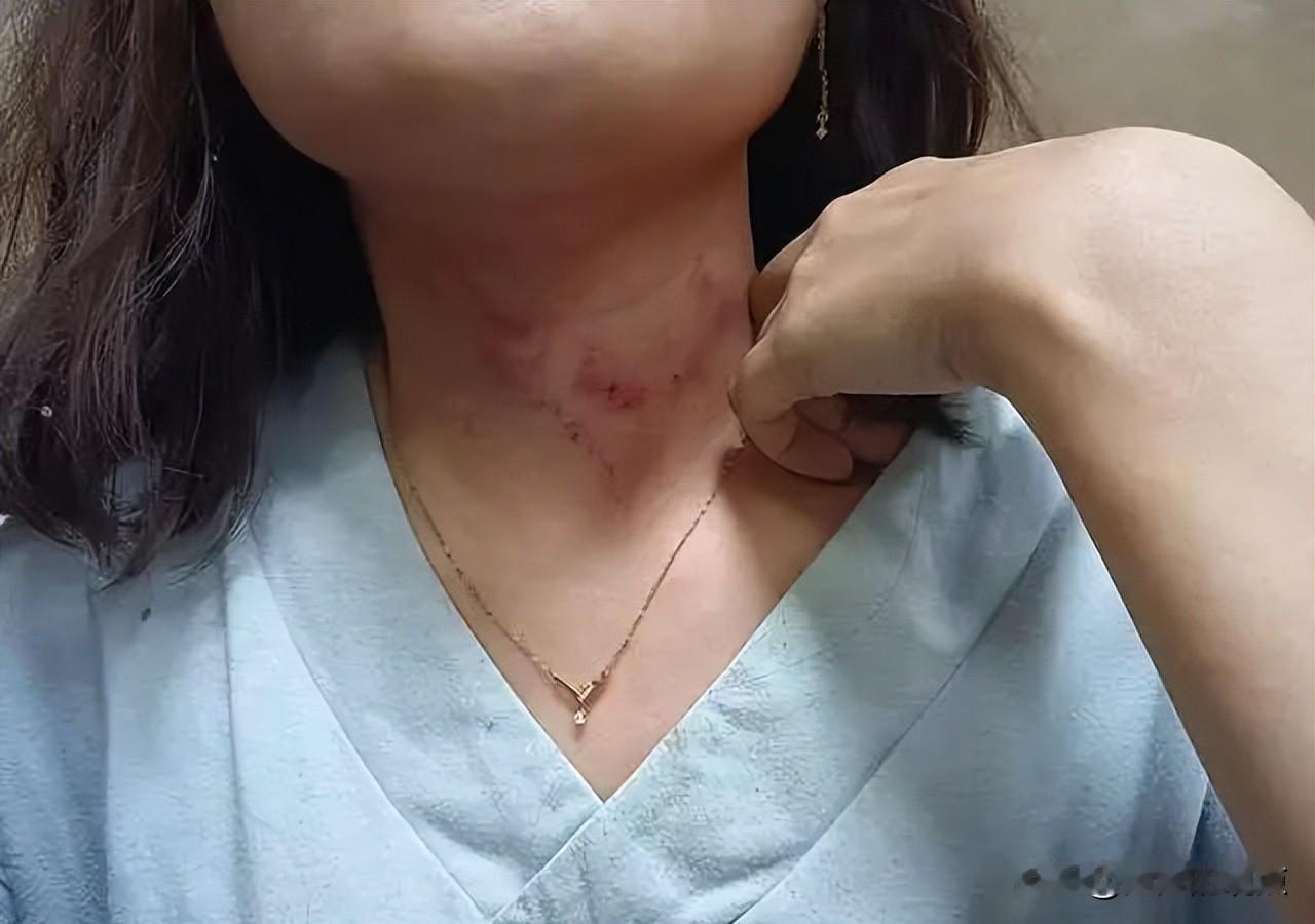四川女子借750元遇暴力勒索，救命恩人拍视频抓证据，嫌疑人扔手机逃跑。
四川德阳
