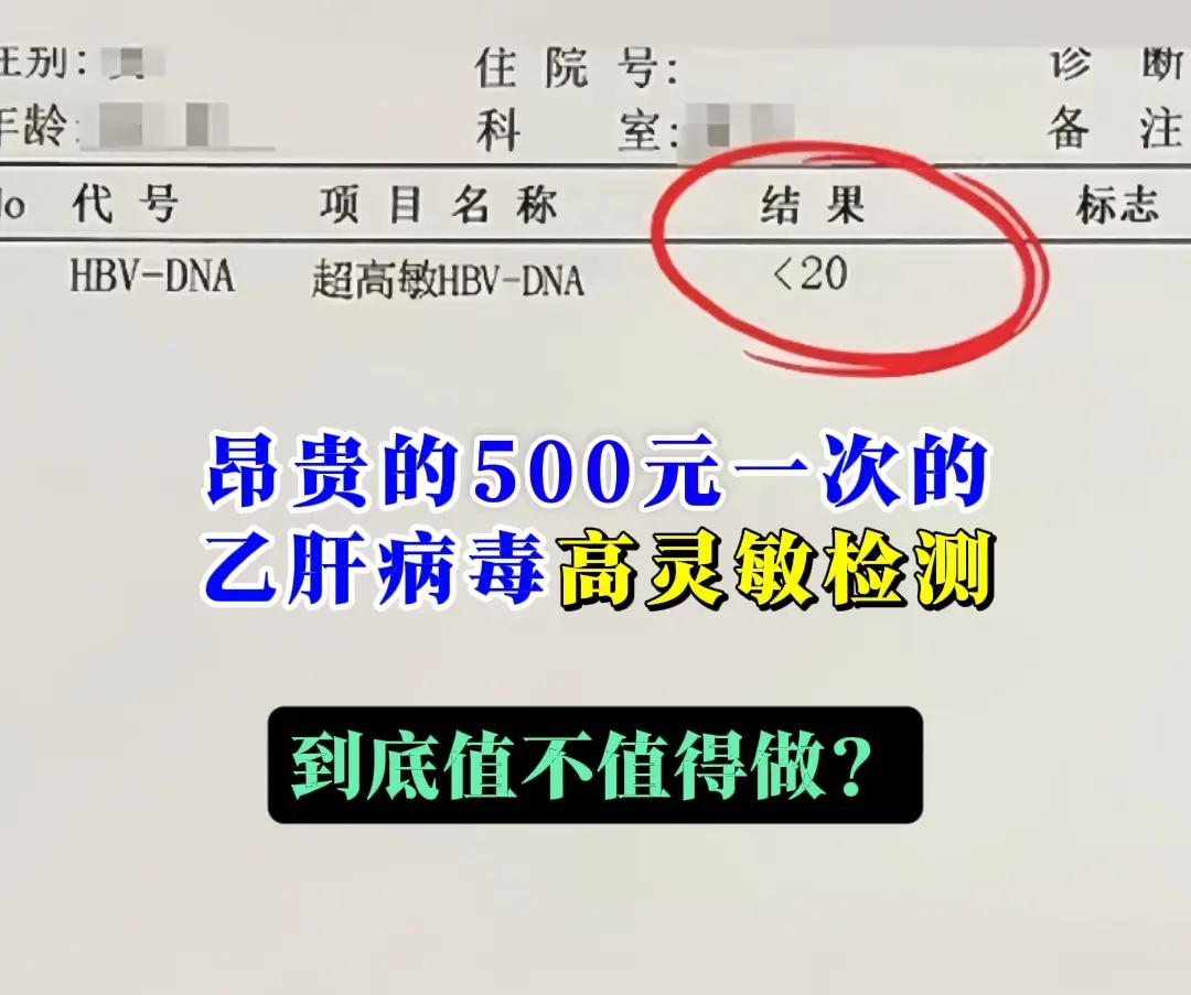从医40多年，经常有患者拿着缴费单问我：“教授，普通病毒检测才几十块...