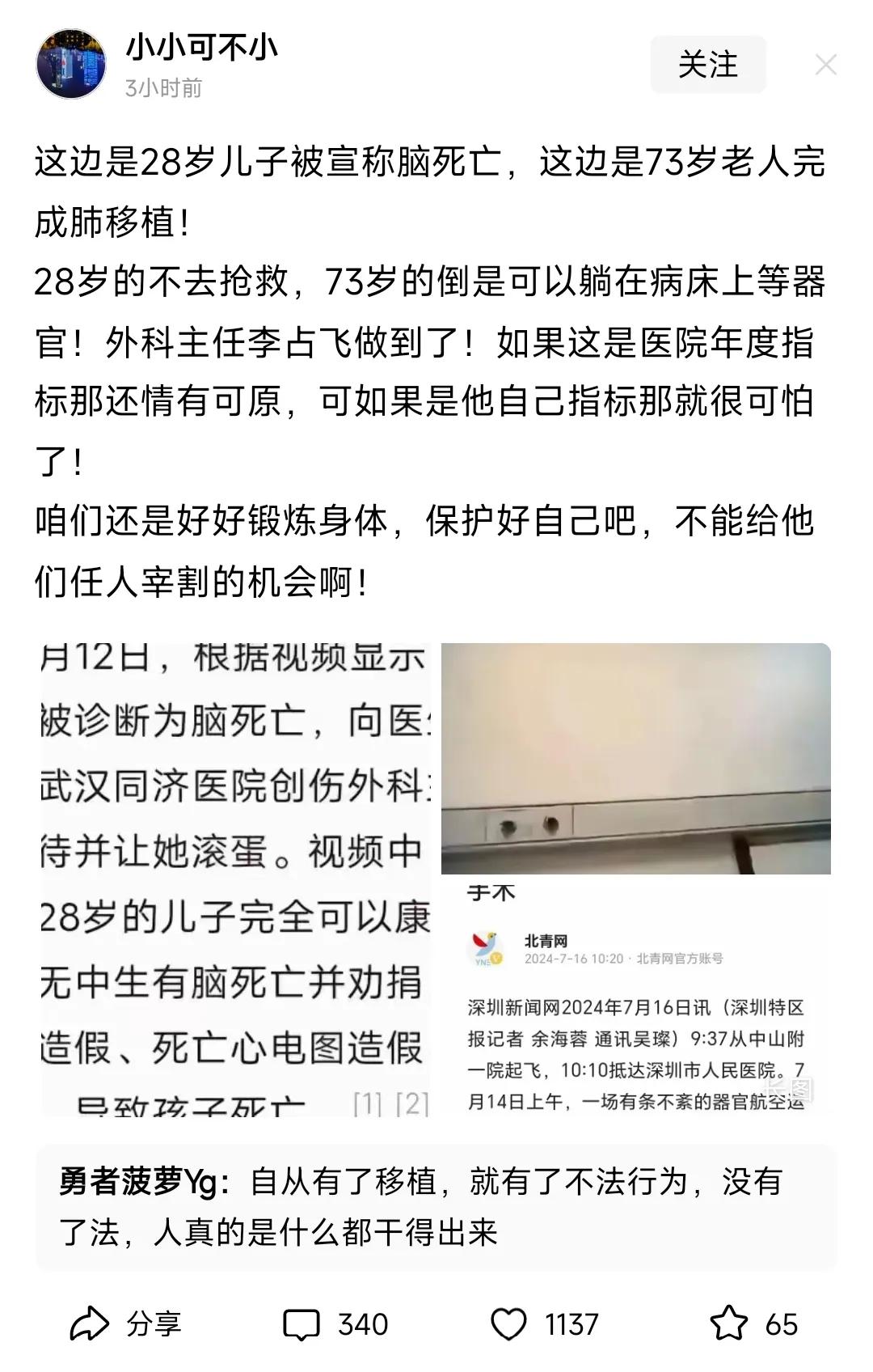 有人竟然公开质疑73岁老人成功完成肺移植手术一事。

莫非在他们看来，73岁的老